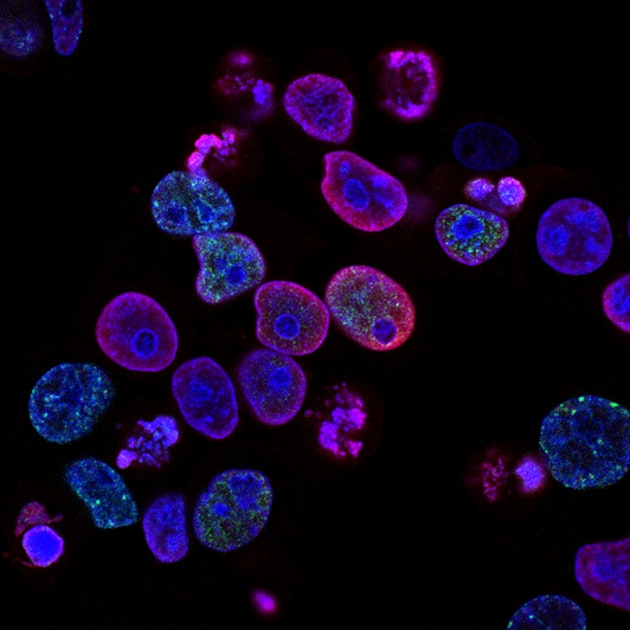 The Future of Cell Therapy with iPSCs